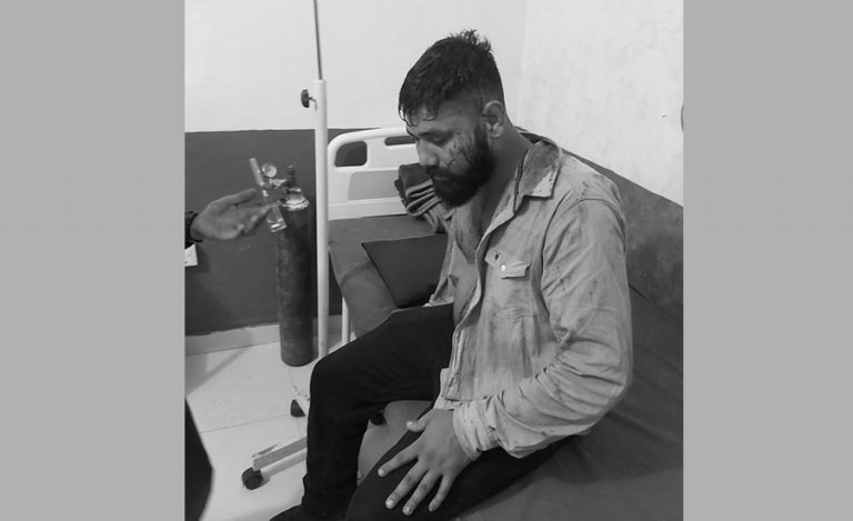 कञ्चनपुरमा तीज कार्यक्रम भइरहेको बेला दुई समूहबीच झडप हुँदा ७ जना घाइते